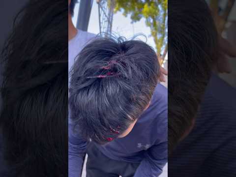 NO PUEDES CONTROLARLO TODO. 🤕 PARTE 2!! #youtubeshorts #shorts #fail #golpe #parkour #puebla #amigo