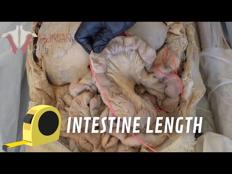 Are Intestines Really 20 Feet Long??? Let s Measure Them!!