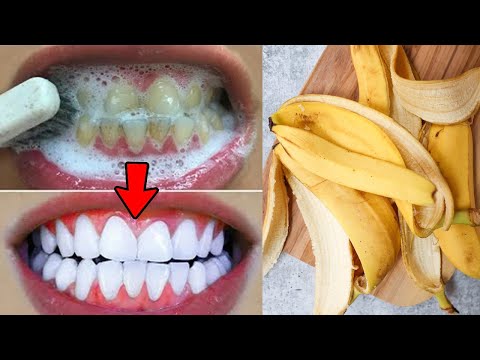 Why is banana peel important for teeth whitening?