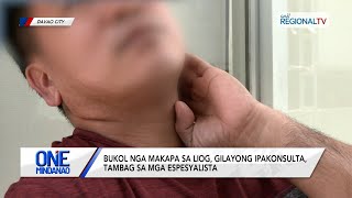 Bukol nga makapa sa liog, gilayong ipakonsulta, tambag sa mga espesyalista | One Mindanao