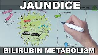 Jaundice | Pathophysiology | Causes, Types & Bilirubin Metabolism