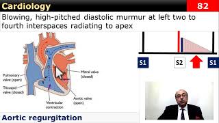 #internal_medicine #cme #usmle #محاضرات_باطنة #ecg #كورسات_باطنة #clinical #clinical #medicine