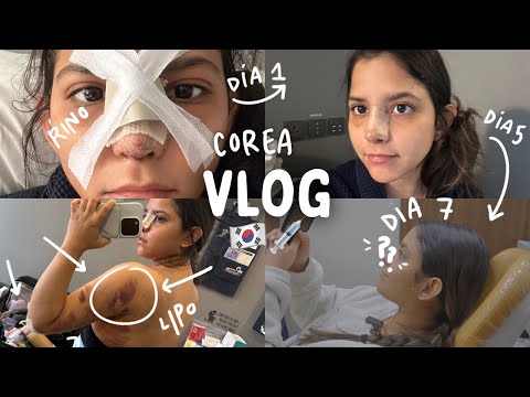 Mi LIPO y RINO en Corea 😳🇰🇷 ~vlog 1 semana!