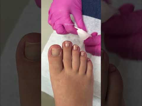 Antes e depois das unhas dos pés 🤤😍