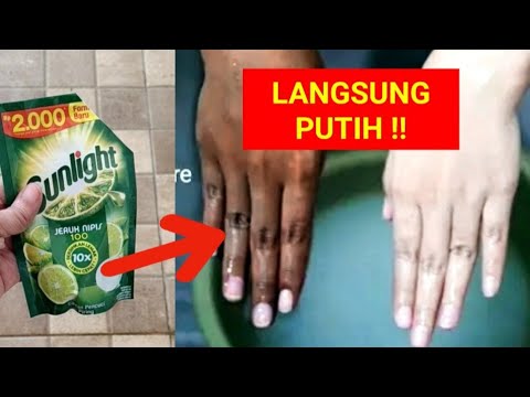 TETANGGA KAGET!! KULIT HITAM BULUK JADI PUTIH MULUS  SEKETIKA DI SANGKA SUNTIK PUTIH!!