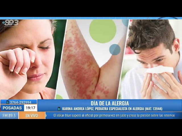 Karina Andrea López. (Mat. 13944). Pediatra especialista en Alergia e Inmunología Infantil