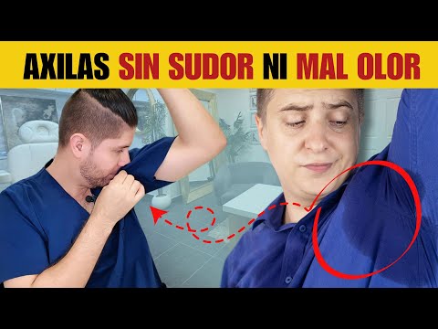 🔴¿Sudoración y Mal Olor en las Axilas? Tratamiento efectivo para la HIPERHIDROSIS - Doctor Lemus