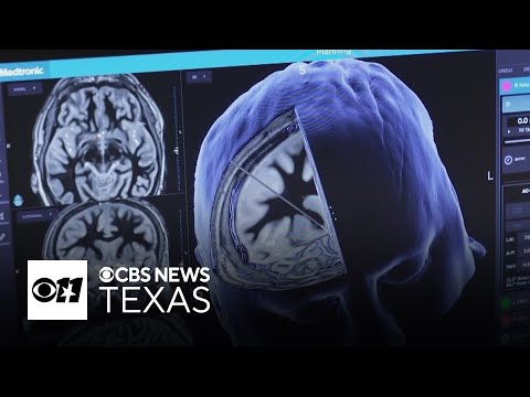 YouTube video thumbnail: Search and Rescue Experts, Nonprofit Write Wandering Toolkit for Those With Dementia