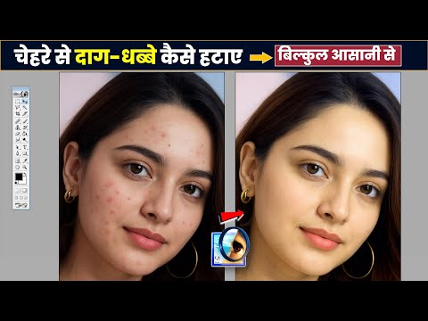 How to remove pimples in photoshop. Remove Pimples & Spots. Photoshop Editing.