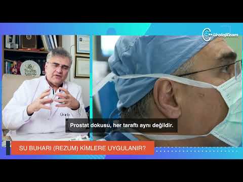 SU BUHARI REZUM KİMLERE UYGULANIR? #prostat #rezumtedavisi #prostatehealth