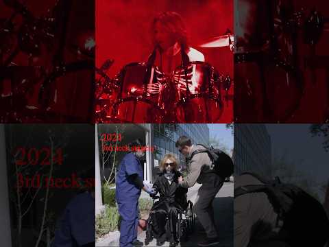 10 months ago today, I had my 3rd neck surgery. I’ve decided to return to the stage 🙏 #yoshiki