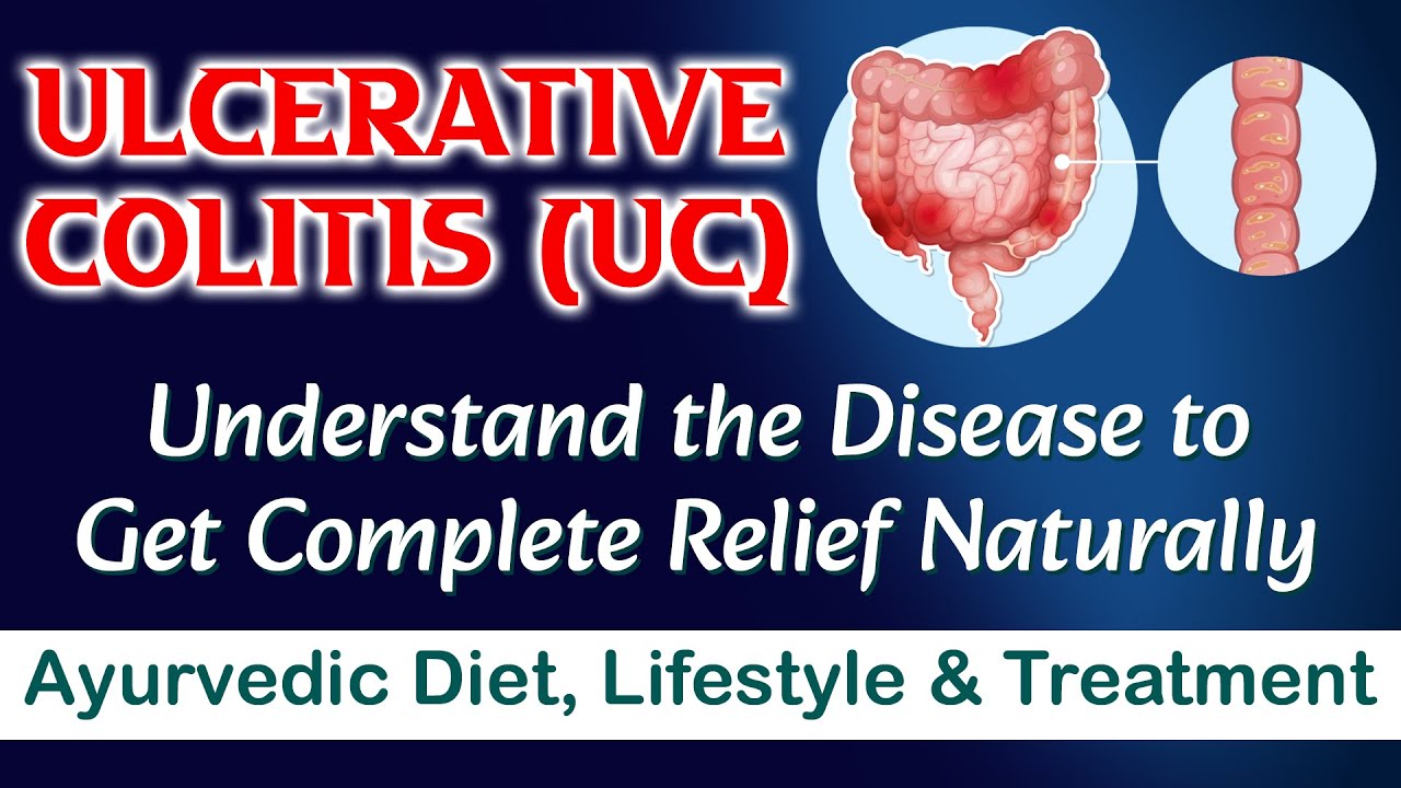 Watch Video Ulcerative Colitis - Understand the Disease to Get Complete Relief Naturally