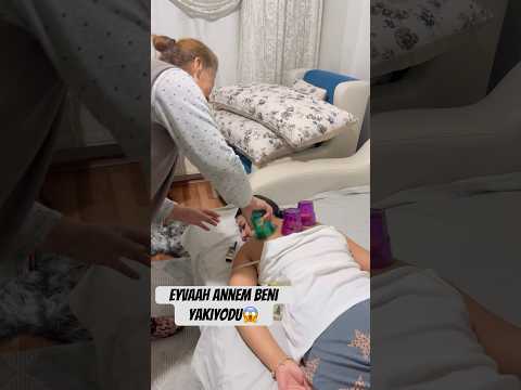 Bu yöntemle ağrılarım geçti #shortvideo #summershorts #vlog #bardakçekmek #hacamat #agri
