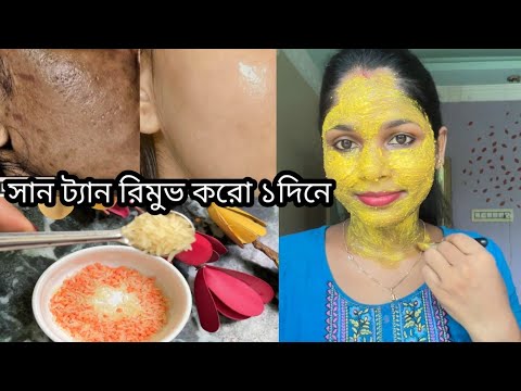 Sun Tan Gone in 1 Day ! | My Top Home Remedy Revealed