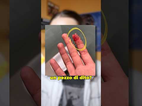 Mi sono tagliata un pezzo di dito... Com'è successo??