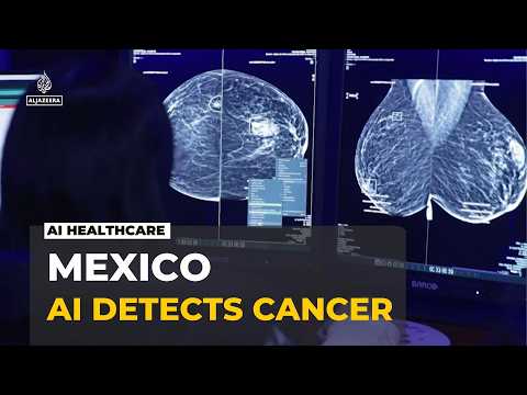 Bridging Mexico's public health gap: AI strengthening early breast cancer detection