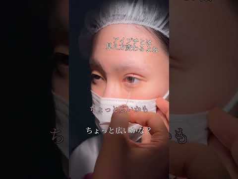 【二重整形】No.1キャバ嬢二日酔いで二重整形#shorts