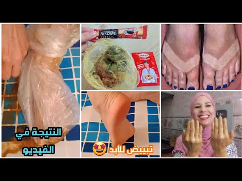 تبييض وازالة تشققات الرجلين ب2درهم فقط 🤩أثار الصندالة /تصبغات/أثار شمس/4Kالنتيجة أمامكم في الفيديو