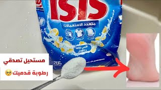 وصفة خطيرة 💞تقشير، ترطيب، تنعيم وتبييض فوري للقدمين وسخ السنين يختفي من اول استعمال🌸 