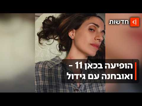 "זכיתי בלוטו": שירה הופיעה בטלוויזיה - הרופא אבחן דרך המסך גידול בצווארה