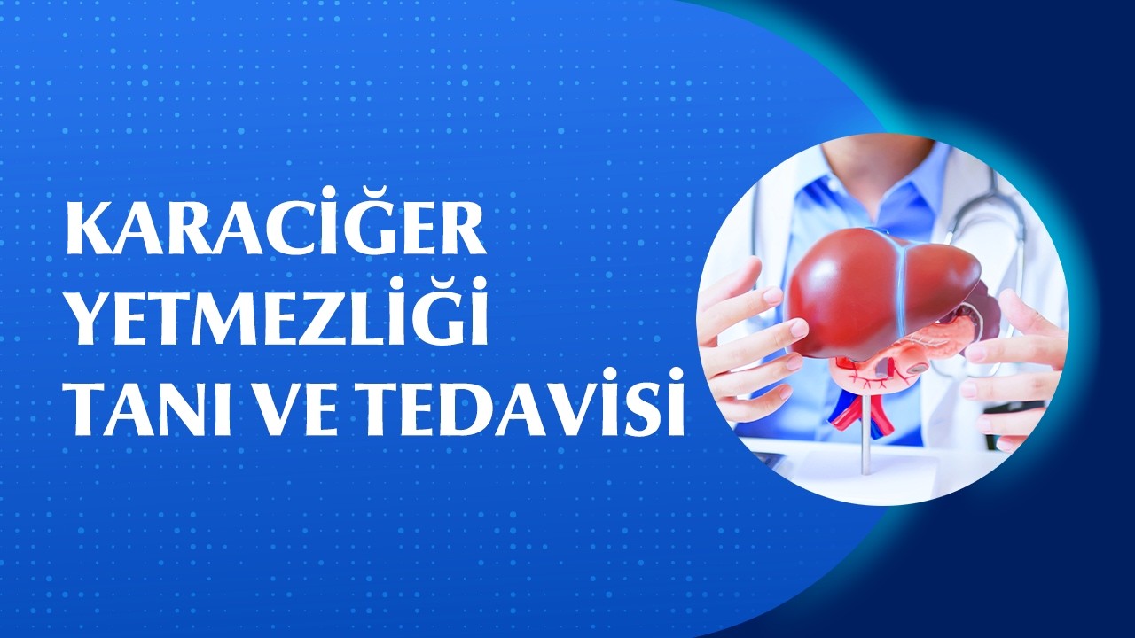 Karaciğer Yetmezliği Belirtileri Nelerdir ve Nasıl Tedavi Edilir?