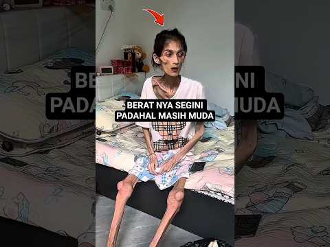 padahal dulu dia cantik #shorts #haru #tawa