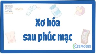 Xơ hóa sau phúc mạc