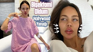 BİŞEKTOMİ SÜRECİM - Yanak Yağlarımı Aldırdım