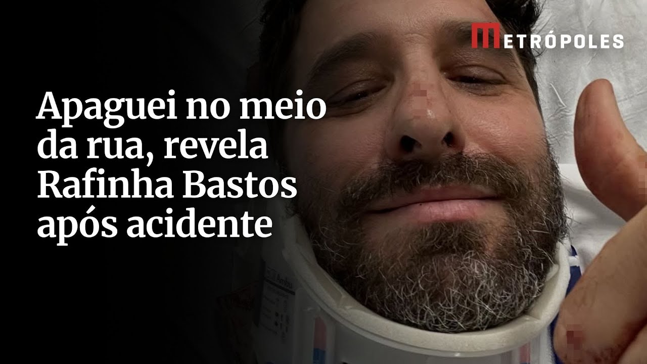 Apaguei no meio da rua revela Rafinha Bastos após acidente