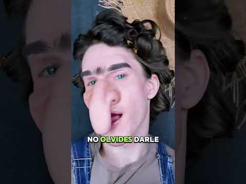 ¿Por qué te pondrían un globo en la nariz? La razón te sorprenderá 👃🎈