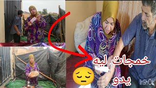 بقا فيا مسكين الحرقة دارت ليه الولسيس دعواتكم معاه بالشفاء🤲0707887604