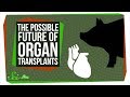 Challenges and Concepts in Xenotransplantation