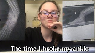 The time I broke my ankle *Storytime* *s3ep13*