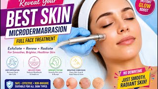 #MicroDermabrasion # skin polishing #london# vtct level3Beauty Therapy Treatment# yt#10-june-2026