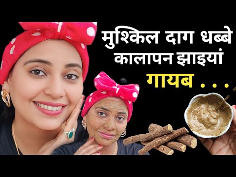 त्वचा की मुश्किल समस्या जैसे झाइयां HYPERPIGMENTATION, DARK SPOTS, MELASMA का इस Remedy से 100% इलाज