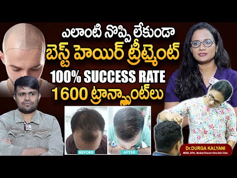 600 ట్రాన్స్మాంట్ లు | 100% SUCCESS RATE | Painless Hair Transplant | Dr. Durga Kalyani | SumanTv