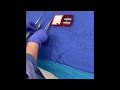 Safe Handling of Sharps in Surgery