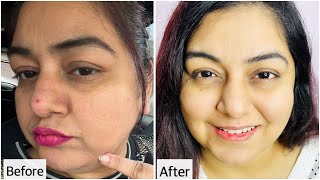 Honest Review | New L'Oréal Paris Glycolic Bright Serum Add Power of Melasyl | JSuper Kaur