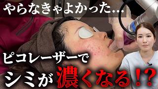 【ピコレーザー/トーニング】治療をすると肝斑(シミ)が濃くなる？後悔しないための方法を解説！【シミ/くすみ/そばかす】