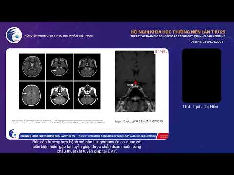 5. BC trường hợp bệnh mô bào Langerhans đa cơ quan với biểu hiện tại tuyến giáp (ThS Trịnh Thị Hiền)