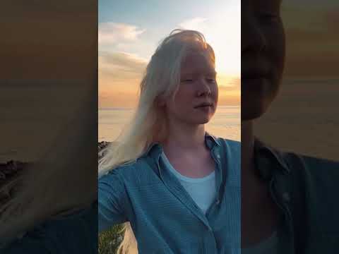 Сестры-альбиносы из Казахстана!