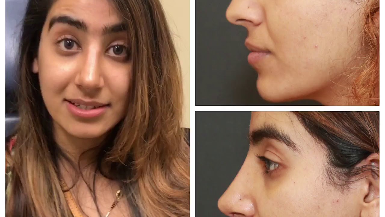 Woman speaking, three images with varying expressions.