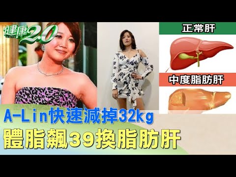 A-Lin快速減掉32kg像溜溜球 體脂飆39換脂肪肝 健康2.0