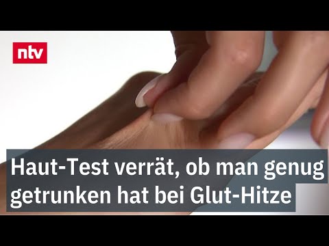 Haut-Test verrät, ob man genug getrunken hat - Hoher Wasserbedarf bei Glut-Hitze
