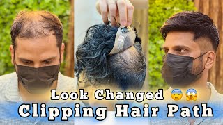 Clipping Hair Patch For Mens | Hair Wigs For Mens | Call on 9650914665