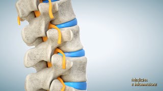 Mal di schiena e Scoliosi nell'adulto: come si trattano le patologie degenerative della colonna