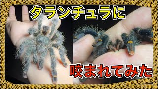 激痛！アマゾンでタランチュラに咬まれてみた