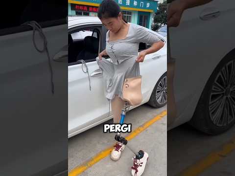 meski pakai kaki palsu,gadis ini tetap berjuang ‼️#shorts