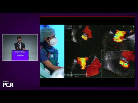 Leading clinical evidence while disrupting the mitral paradigm with clip therapy - EuroPCR2022