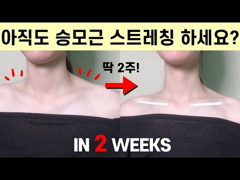 80만명이 효과를 본 승모근 없애는 운동, 일자어깨 직각어깨 만들기✨
